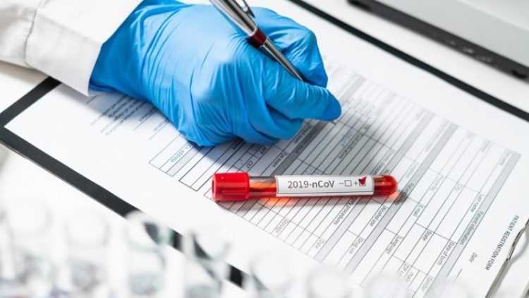 Daha 12 nəfər koronavirusa yoluxdu