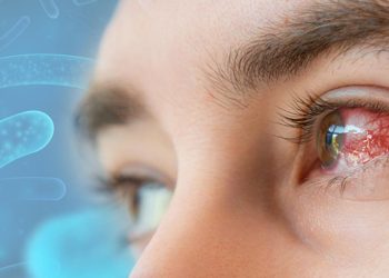 ABŞ-ı həyəcanlandıran bakteriya: Gözdə əriyir!  18 ştatda 81 nəfərdə müşahidə edilib, 4 nəfər ölüb