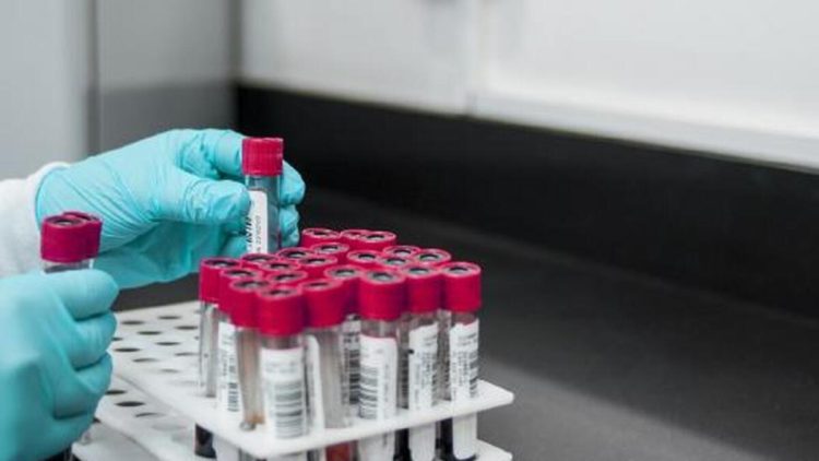 İngiltərədə yoluxucu cinsi xəstəliklər rekord həddə çatıb