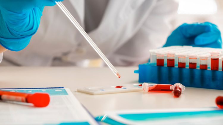 Qan xərçənginə tutulma riski yüksək olan yeni genlər aşkar edildi