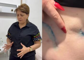 Prokurorluqda pasiyentin ölüm işində adı keçən həkim yenidən cərrahlıq edir? – VİDEO