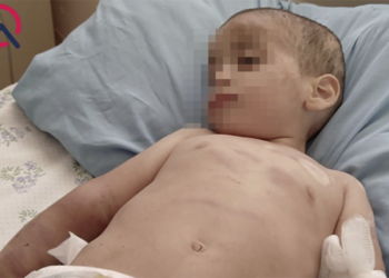 Döyülən uşaqların vəziyyəti – Açıqlandı