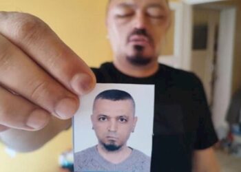 İnternetdən aldığı şampun həyatını kabusa çevirdi — FOTO