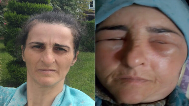 Lənkəranda qonşular arasında dava olub, xəsarət alan var