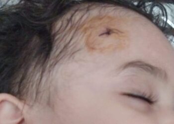 “Etimad KİDS” bağçasında uşağın başı yarıldı, ailəsinə xəbər verilmədi (FOTO)