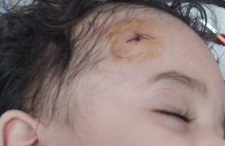 “Etimad KİDS” bağçasında uşağın başı yarıldı, ailəsinə xəbər verilmədi (FOTO)